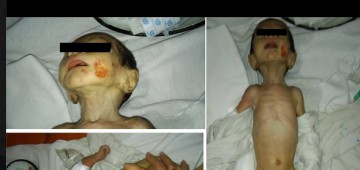 Căpăţână, precizări despre copilul abandonat în Spitalul Judeţean: Era muribund, astăzi e sănătos