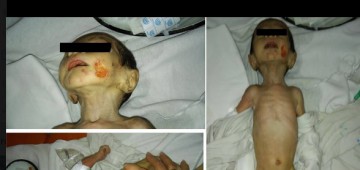 Fraţii copilului abandonat în Spitalul Judeţean, preluaţi de DGASPC