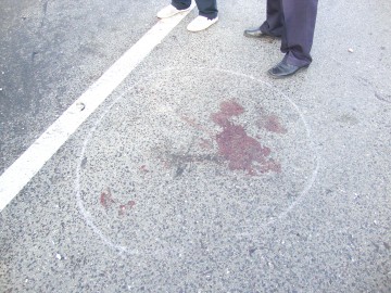 O tânără din Năvodari, accidentată în Tulcea
