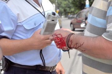 Un constănţean a ajuns la spital după ce a provocat un accident: era BĂUT