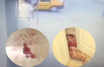 Caz şocant în Constanţa: taximetrist înjunghiat în gât de un client! Agresorul şi-a înfipt un cuţit în torace şi a murit la spital