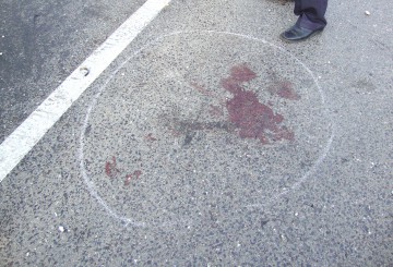 Bătrân de 82 de ani, accidentat pe bulevardul Mamaia