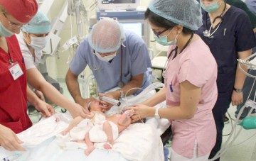 Radu Spătaru, directorul medical al Spitalului „Marie Curie”: Siamezele au inima și ficatul comune