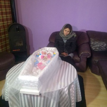 Siamezele născute la Constanţa nu au avut şanse de supravieţuire
