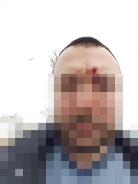 Un angajat al unei clinici susţine că a fost bătut de şef