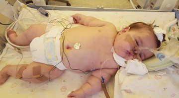 Drama unui bebeluş de 7 luni: de când s-a născut, stă numai în spital