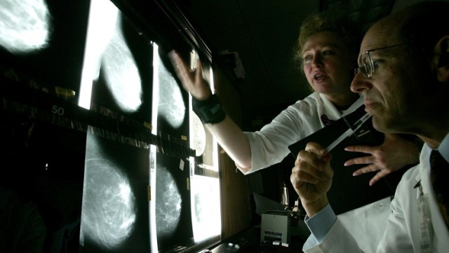 Studiu: Soluția la îndemâna oricui pentru a reduce riscul dezvoltării mai multor tipuri de cancer