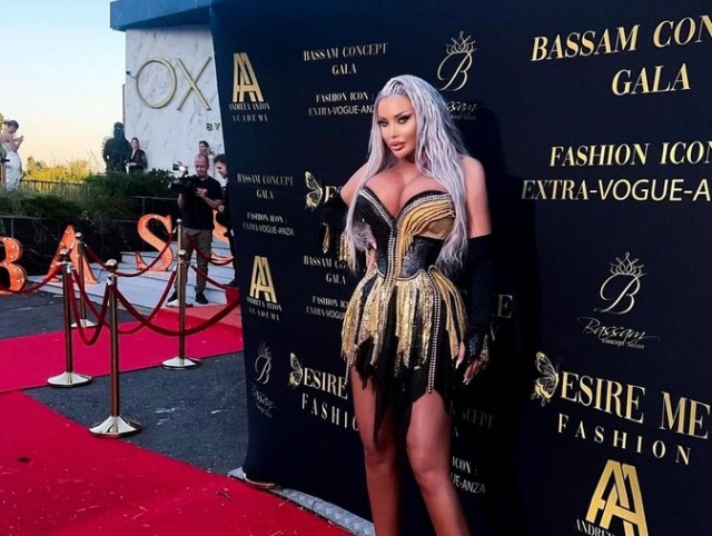 Cât de mult s-a îngrăşat Loredana Chivu. Dansatoarea e de nerecunoscut