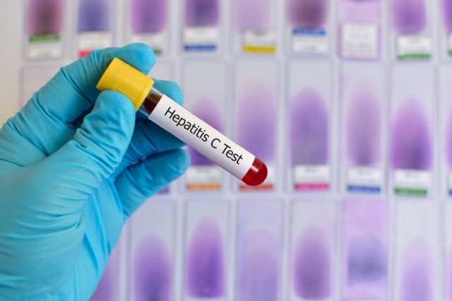 Testări gratuite la Năvodari pentru prevenirea infecției cu HIV sau cu virus hepatic B și C