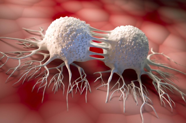„Înfometarea celulelor“, o nouă metodă revoluționară în lupta cu tumorile