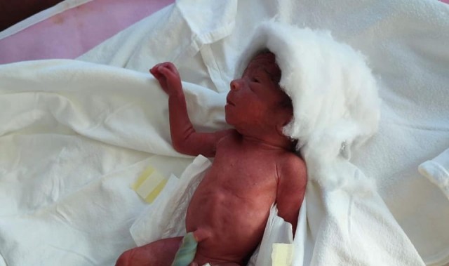 Incredibil! Bebeluș de 500 de grame, născut la Spitalul din Hârșova; starea lui este bună