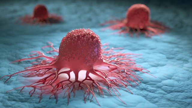 Descoperire majoră: 99% dintre celulele canceroase, distruse într-un experiment