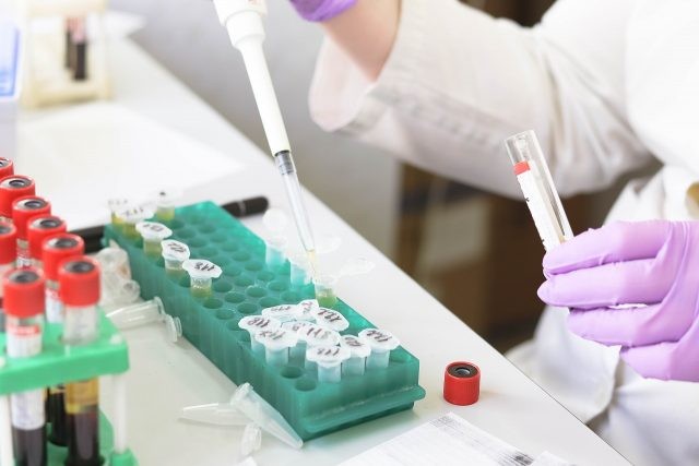 Depistarea cancerului înainte de apariția simptomelor. Analize recomandate