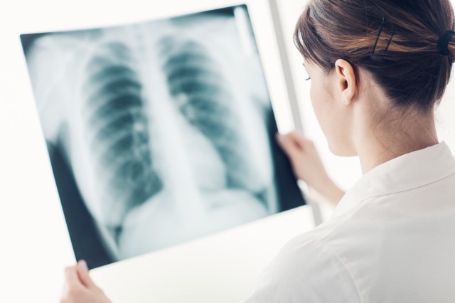 Spitalul 'Victor Babeş' din Timişoara a lansat platforma pneumocontrol.ro, pentru pacienţii cu afecţiuni pulmonare