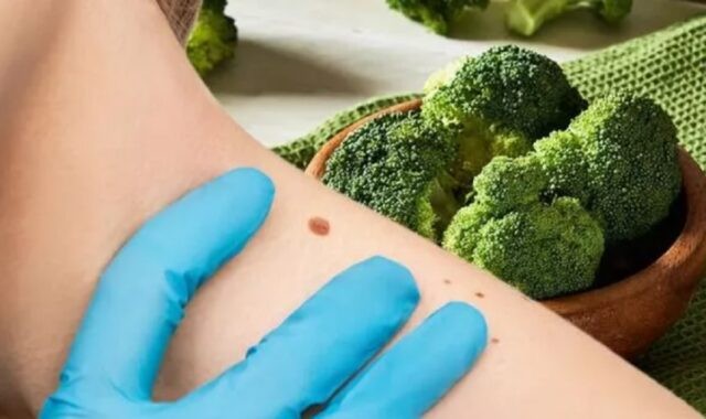Nutriția și cancerul: Analiză privind dieta anticancerigenă