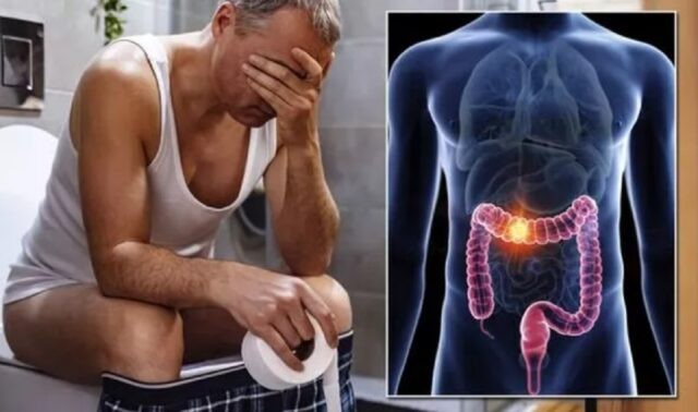 Medic gastroenterolog, detalii importante despre un tip de cancer agresiv