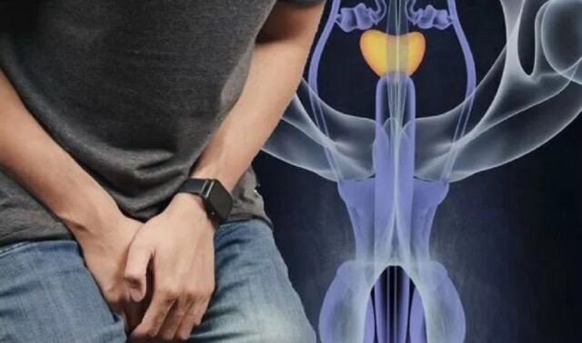 Semnul de mărimea unui bob de mazăre care apare la 90% dintre pacienții cu cancer testicular