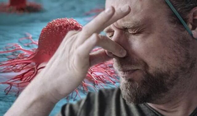 Semne de cancer: mirosul care poate semnala o tumoare