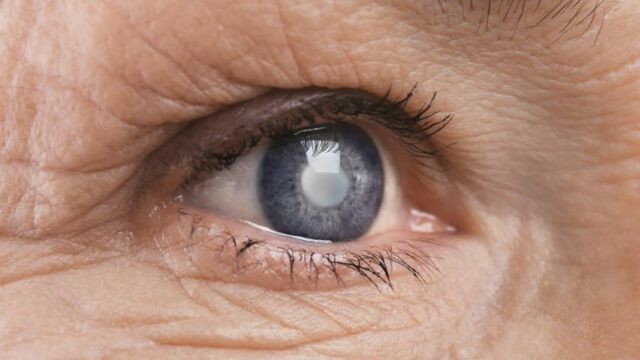 Alimente care pot ajuta la scăderea riscului de cataractă