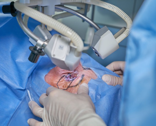 Medicii din Italia au făcut primul implant de retină artificială care redă vederea celor pe cale să orbească
