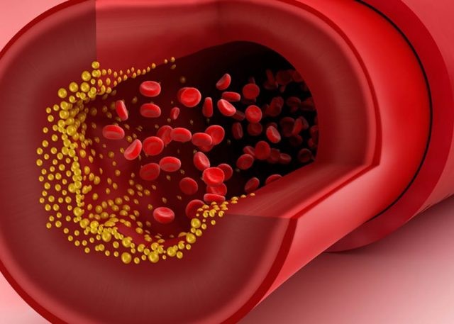 Care sunt valorile normale ale grăsimilor din sânge și ce înseamnă, de fapt, colesterol „bun”