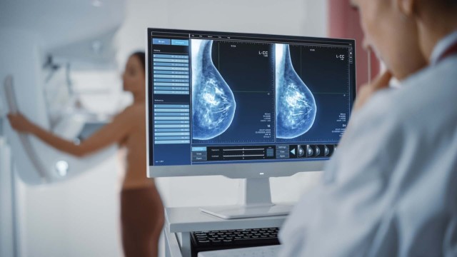 Detectarea precoce a cancerului mamar: de ce este atât de importantă