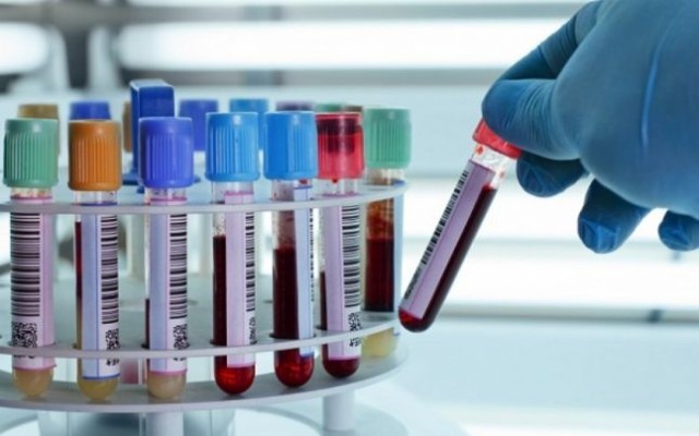 Descoperire revoluționară: Un test de sânge depistează cancerul fără simptome