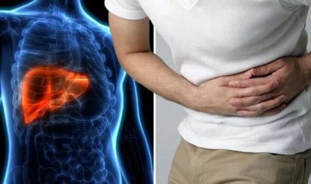 Medic: „Ficatul mărit poate produce balonare și dureri în această zonă a abdomenului”