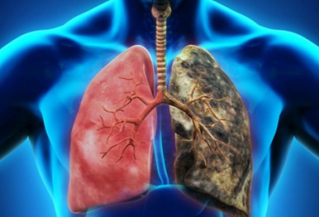Cum poți dezvolta cancer pulmonar fără să fumezi. „Ucigașul tăcut” din casa ta