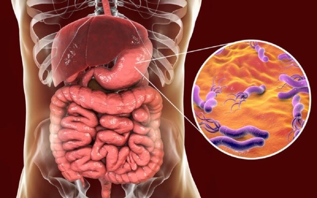Gastroenterolog: 70% din populația României are această bacterie