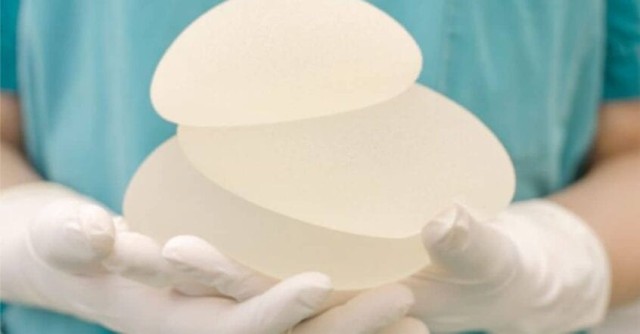 Studiu: Implanturile mamare cu silicon, o 'eroare medicală istorică'