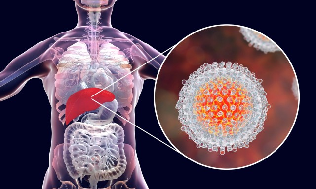 Virusul hepatitei B este mai prezent la persoanele tinere, iar hepatita C la persoanele de peste 50 de ani