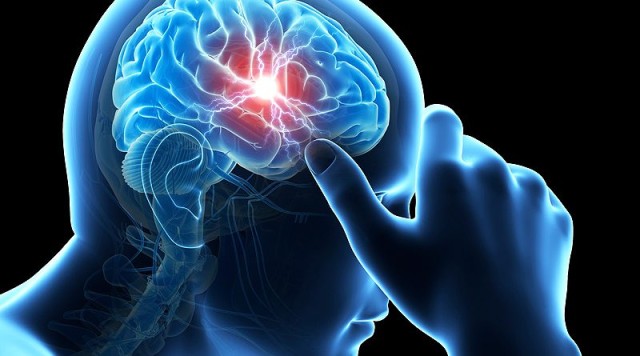 Cele 'mai luminate minţi' din domeniul bolilor cerebro-vasculare transferă expertiză spre România