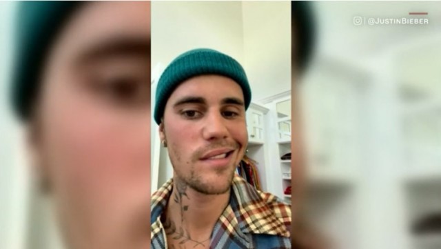 Justin Bieber anunță că are paralizie facială din cauza sindromului Ramsay Hunt