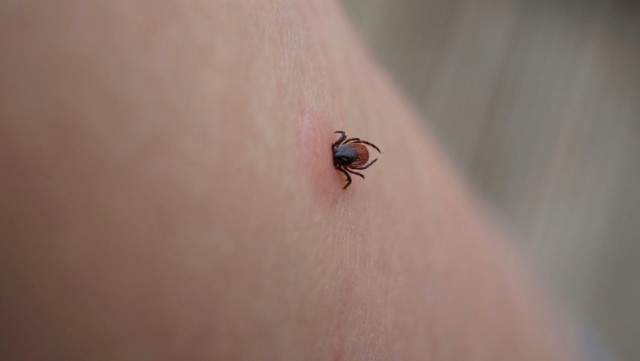 Cum se scoate o căpușă din piele și ce greșeală trebuie evitată