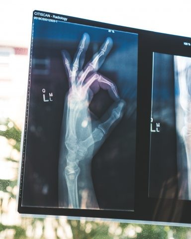Ai dureri de spate și de oase? Iată ce vitamine îți lipsesc