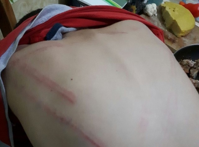 Și-a rupt în bătaie fiul vitreg, că a furat din piață