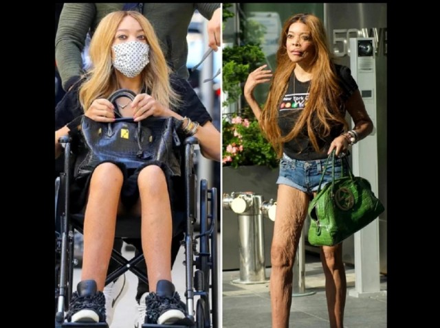 Superstar american, devenită ruină din cauza adicțiilor! Fosta prezentatoare arată groaznic