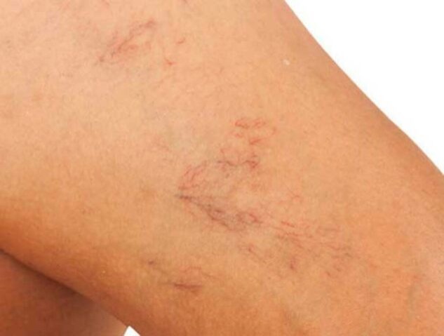 Hepatita autoimună: când sistemul imunitar atacă celulele hepatice