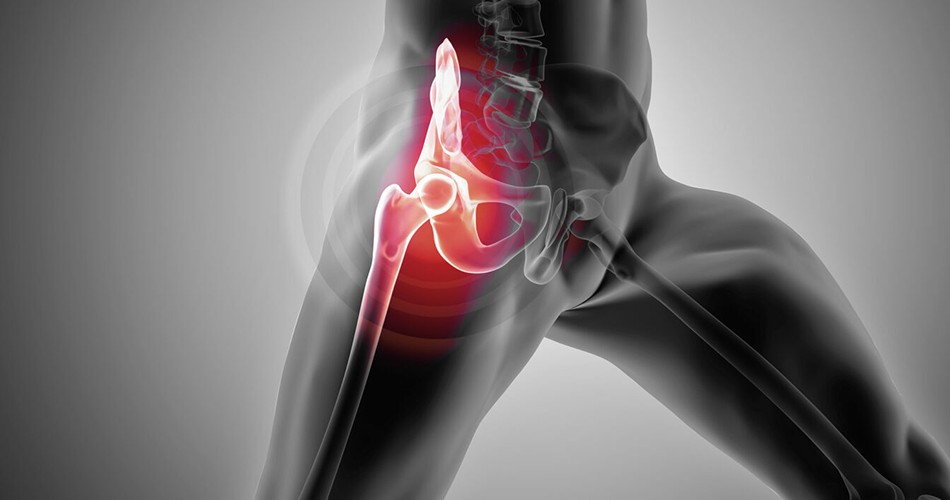 Dureri la nivelul șoldurilor și mers modificat? Iată ce diagnostic se ascunde în spatele simptomelor