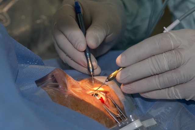O clinică medicală privată, acuzată de trafic de cornee. Sute de pacienți ar fi beneficiat de transplanturi ilegale