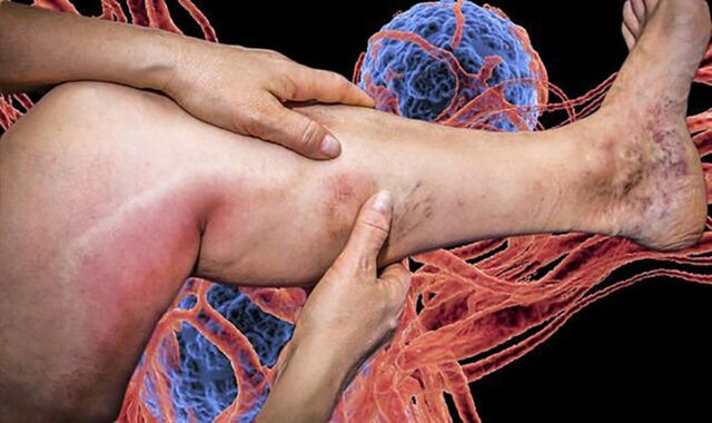 Deficitul acestor vitamine duc la probleme de coagulare a sângelui
