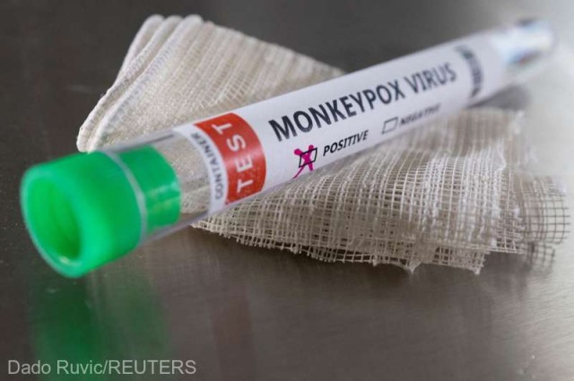 Un nou caz de variola maimuţei a fost diagnosticat în România