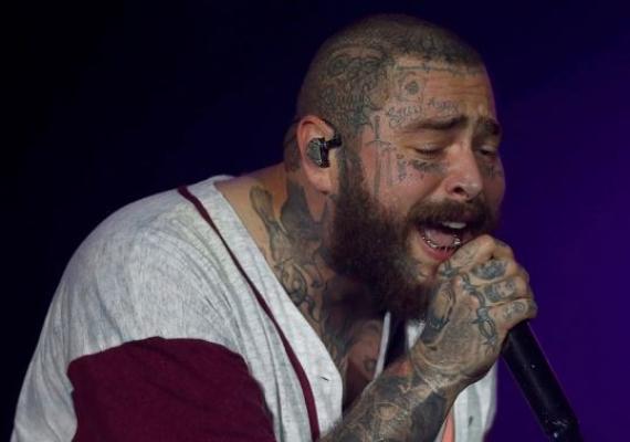 Post Malone, spitalizat la o săptămână după ce a căzut pe scenă