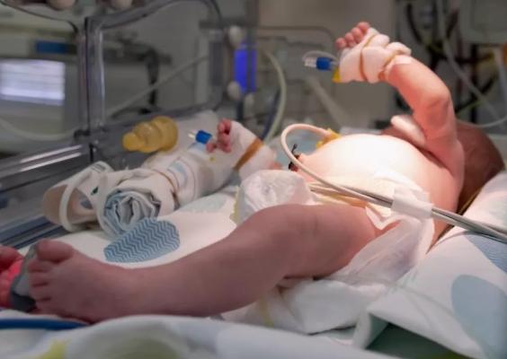 Un bebeluş a primit o grefă de intestin printr-o procedură realizată în premieră mondială
