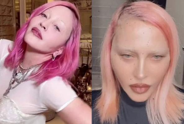Madonna, desfigurată la propriu! Nu știe cu ce să mai atragă atenția: „Arată ca un ou fiert!“