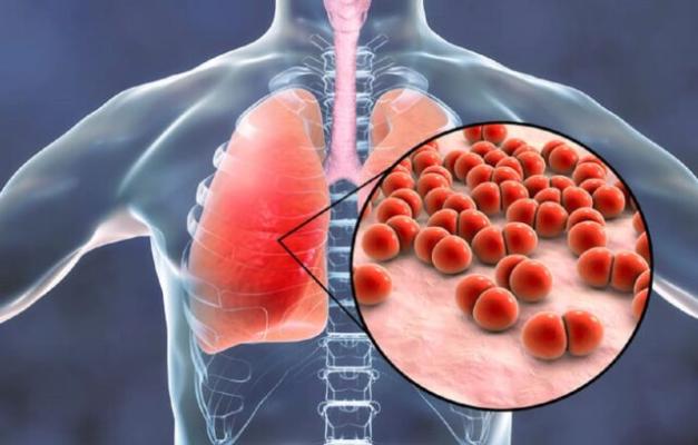 Top 10 remedii pentru flegmă și mucus ușor de pregătit acasă!