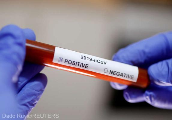 Studiu: Reinfectarea cu SARS-CoV-2 este mai riscantă decât infecţia iniţială