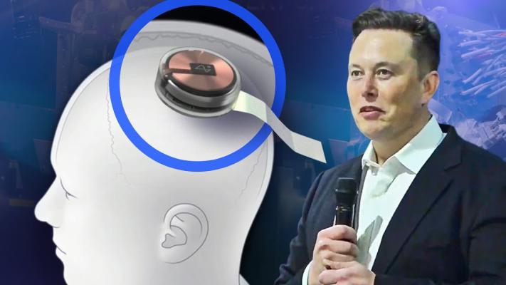 Elon Musk se așteaptă ca testele pe oameni cu cipul cerebral Neuralink să înceapă în 6 luni