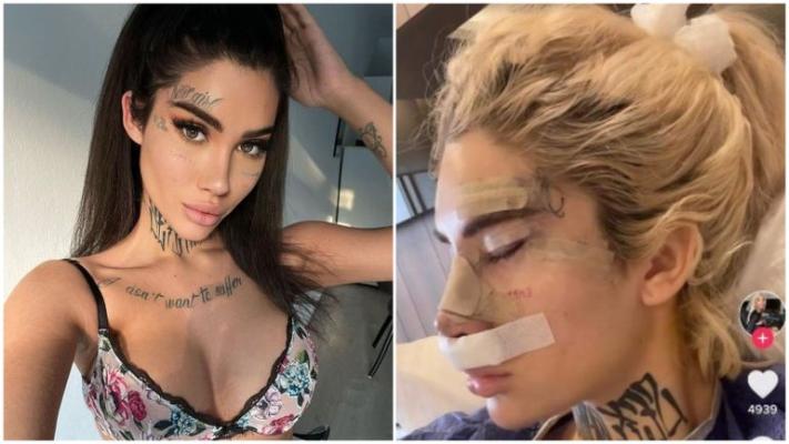Bia Khalifa a trecut din nou pe la medicul estetician